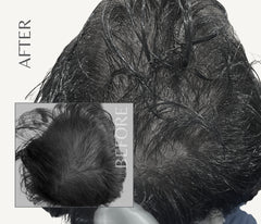 NanoInfuser - Microneedling Serum Applicator / Dermastamp