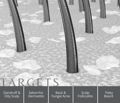 Degrease Pro - Anti Dandruff Scalp Serum