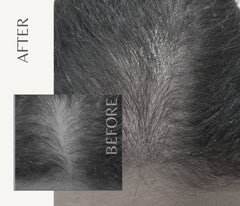 NanoInfuser - Microneedling Serum Applicator / Dermastamp