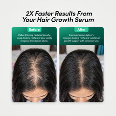 2x faster results when used with a hair growth serum