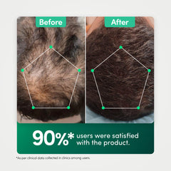 90 percent reported visible improvement, before and after