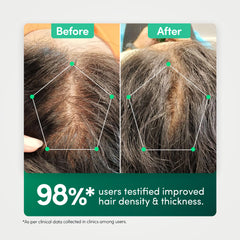 98 percent testified to improved hair density and thickness