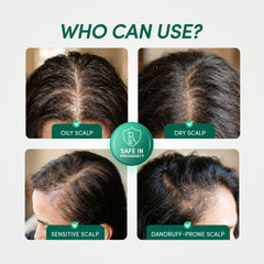 Who can use Octapep: oily or dry scalp, safe in pregnancy