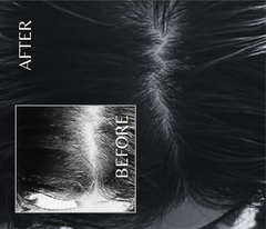 Octapep - Hair Growth Scalp Serum