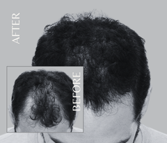 Octapep - Hair Growth Scalp Serum